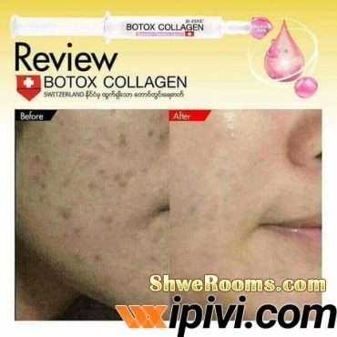 Botox  collagen sell at $15