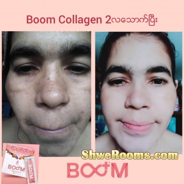 Boom Coffee, Fiberry, Collagen and Soap available