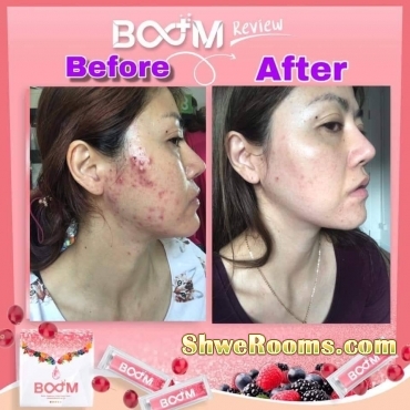 Boom Coffee, Fiberry, Collagen and Soap available